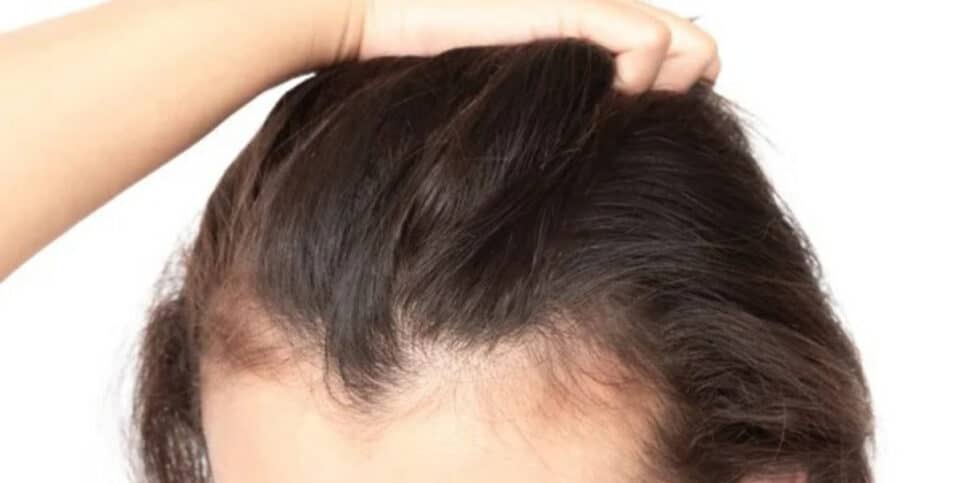 Mande a oleosidade embora! Mantenha o seu cabelo saudável (Foto: depositphotos)